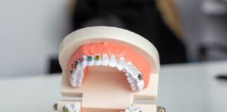 teeth braces