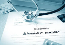 bladder cancer written on paper