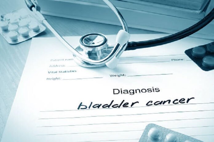 bladder cancer written on paper