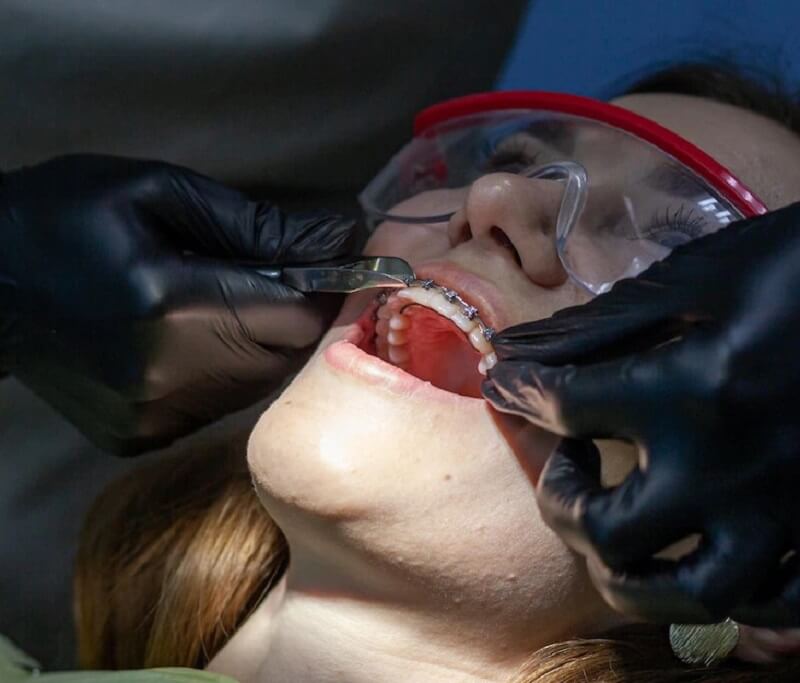 A-woman-at-a-dentist
